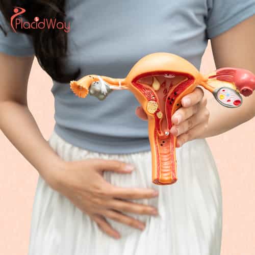 Cervical Cancer Care in Tijuana: Integrative Oncology as an Effective Alternative